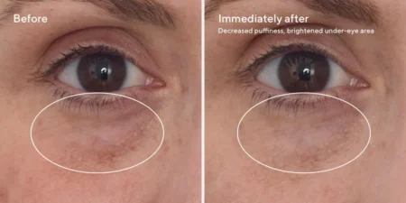 murad producten. Murad review. Murad skincare. Beste skincare tegen vochtwallen. Murad kopen. Huidverzorging kopen.